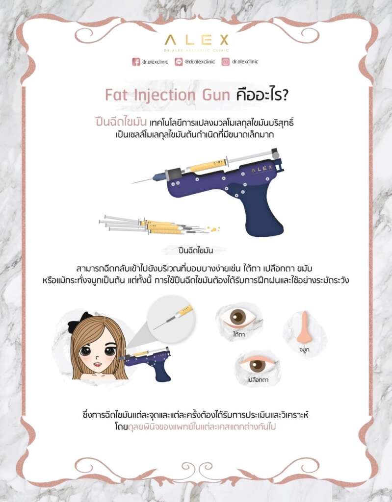 Maft Gun เติมไขมันเท่ากันทุกจุดมั่นใจ