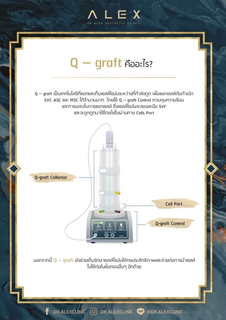 Q - graft เป็นเทคโนโลยีที่แยกและเก็บเซลล์ไขมันระหว่างที่กำลังดูดเพื่อแยกเซลล์ต้นกำเนิด