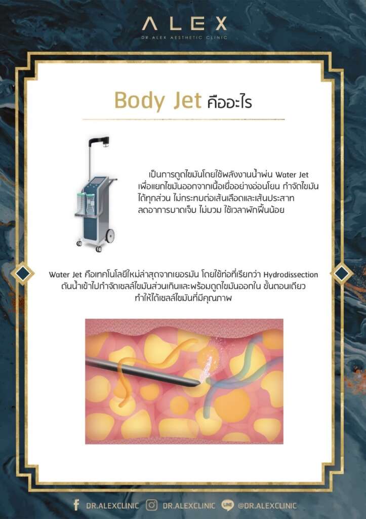 เก็บไขมันอย่างอ่อนโยนด้วย Body-jet