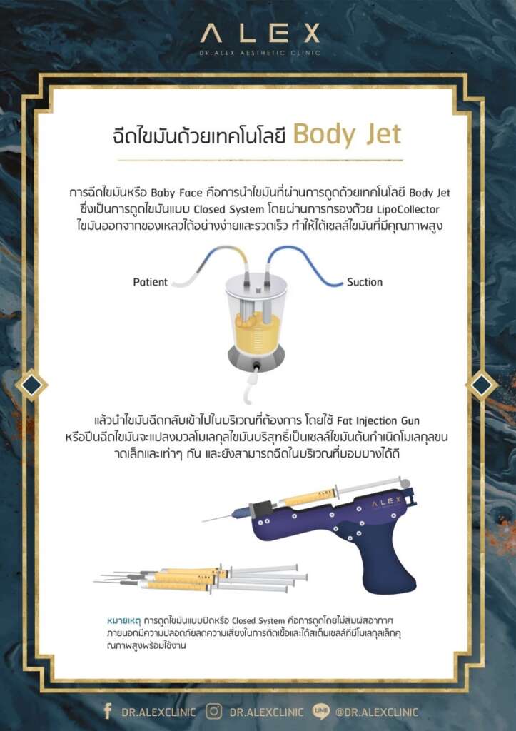 ปั่นกรองไขมันให้มีขนาดเท่ากันด้วน LipoCollector